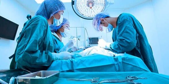 Chirurgie de marire a penisului